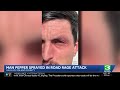 Vallejo police investigate suspected road rage incident after Army veteran is pepper-sprayed