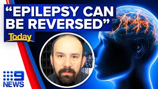 Could this daily pill cure epilepsy? World-first trial begins | 9 News Australia
