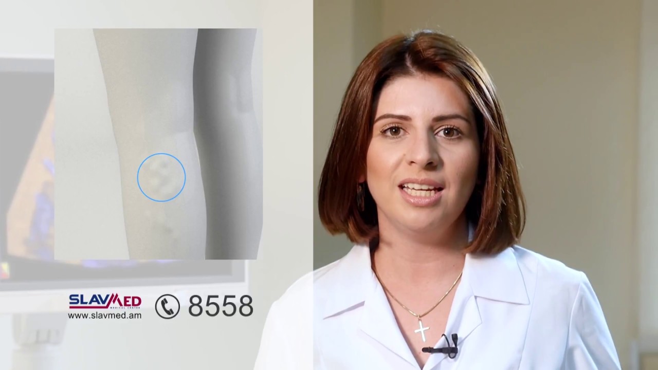 Դուպլեքս հետազոտության նորագույն սարքավորում «Սլավմեդ» բժշկական կենտրոնում