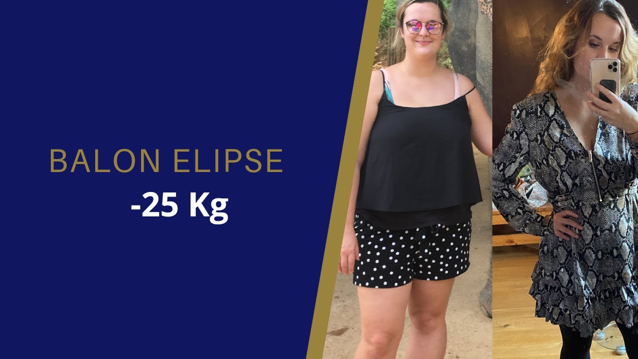 Ballon Elipse-Allurion : -25 KG PERTE DE POIDS SANS CHIRURGIE - YouTube