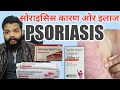        psoriasis cause symptoms  treatment in hindi