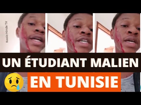 Attaque contre les Africains en tunisie: Un étudiant Malien défiguré par un Tunisien à Menzek Jemil.