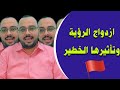 أعراض ازدواجية الرؤية في العين وأسبابها 