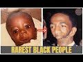 13 Rare Black Individuals With Unique Features You Won’t Believe Exist | Hollywood Revealed