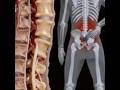 Do you know lumber stenosis pain #painrehabb #lumberpain