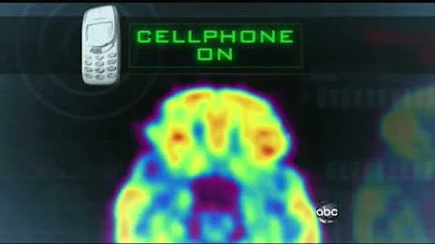 Cell Phones Mysterious Effects on the Brain 2/22/2011 - DayDayNews