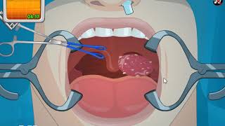 เกมส์ผ่าตัดต่อมทอนซิล เห็นแล้วสยิวกิ้ว Tonsil Surgery [พี่อู๊ด] screenshot 3