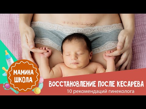 Восстановление после родов:  кесарево сечение