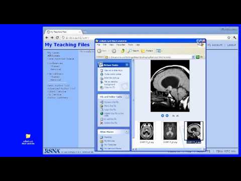 Basic Authoring on the RSNA MIRC Teaching File Software