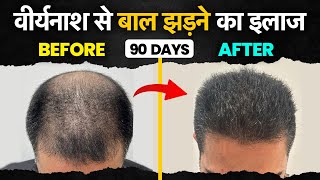 Hairfall due to masturbation || Hasthmaithun se hone wale hair fall ka ilaaj || #hairfallsolution