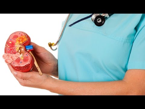 Лапароскопическая резекция почки.  Рак правой почки