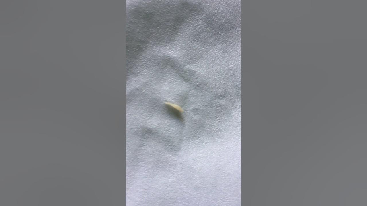 Can humans get tapeworms from cats? YouTube