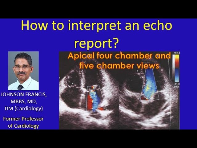 How to interpret an echo report? class=
