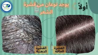 أنواع قشرة الشعر