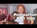 HOW TO TAKE DOWN SOFT LOCS//POSTPARTUM MAKING ME BALD,ANY TIPS?