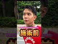 【糸リフト】小顔目指してたから東京中央美容外科銀座有楽町院でTCB式小顔美肌再生系リフト受けてきた💕✌️#shorts