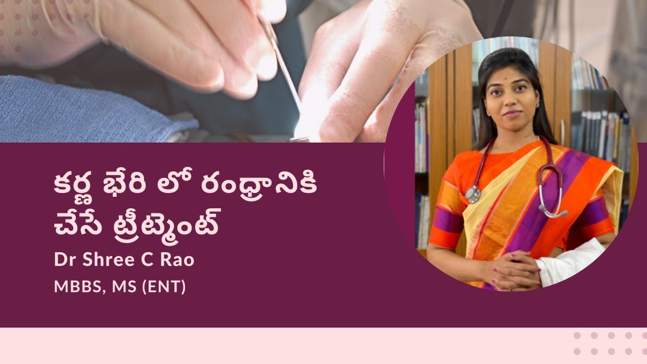 కర్ణ భేరి లో రంధ్రానికి చేసే ట్రీట్మెంట్ | Dr Shree C Rao, MBBS, MS(ENT) | EarSurgeon.in