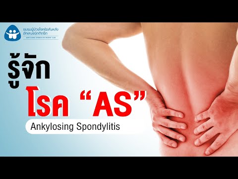 โรค AS (Ankylosing Spondylitis) หรือ โรคข้อกระดูกสันหลังอักเสบยึดติด คืออะไร สาเหตุ และอาการของโรค