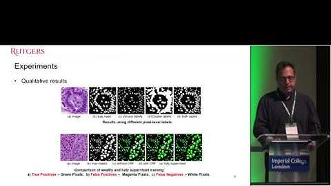 MIDL 2019, Day 2: Presentation by Dimitris Metaxas