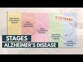 Stages And Life Expectancy Of Alzheimer S Disease 