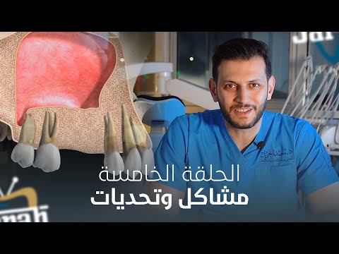 All Videos
