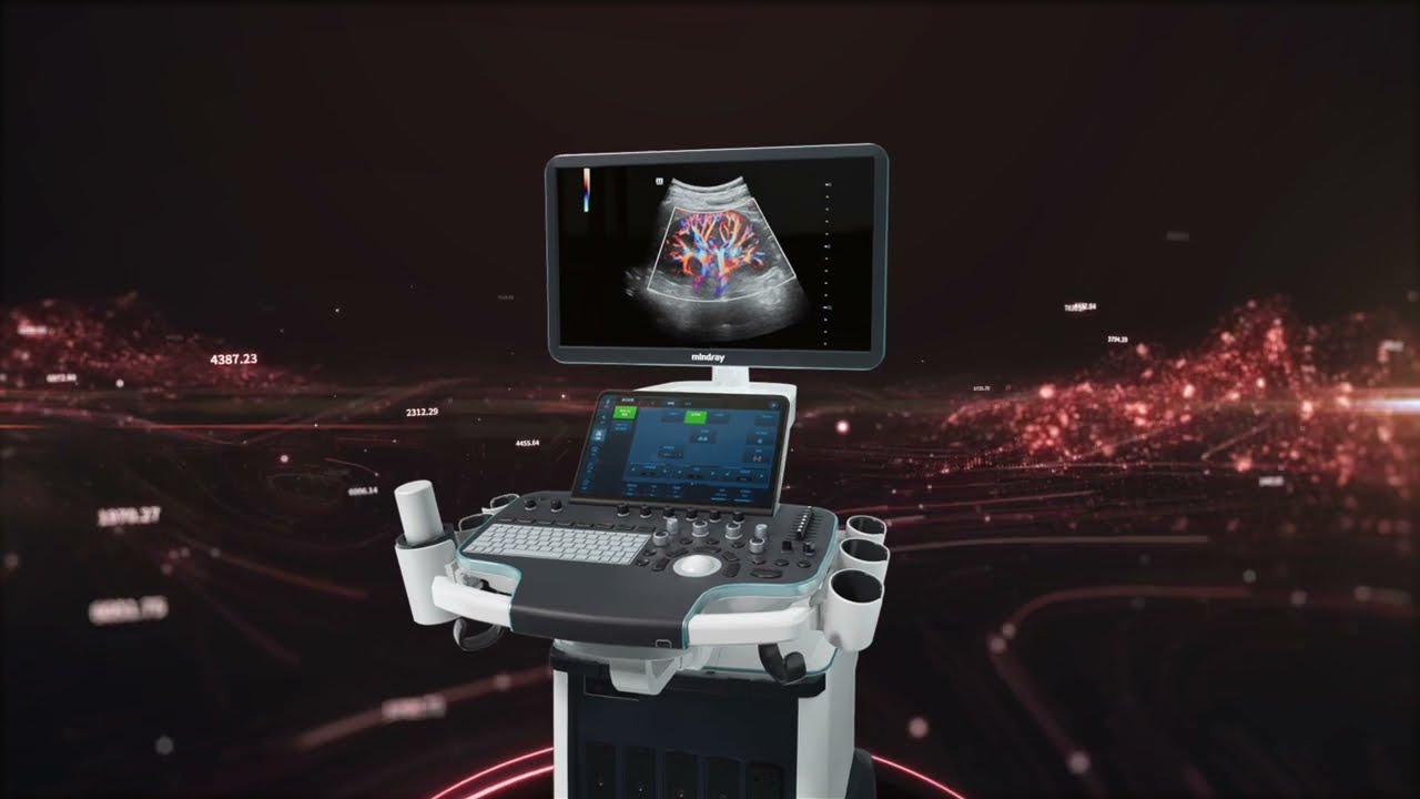 A New Leap for Precision Ultrasound: Resona R9 Platinum Edition