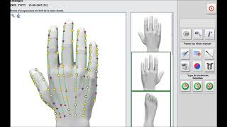 metatron hunter mesure les points d'acupuncture