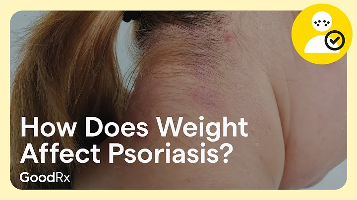 How Does Weight Affect Psoriasis? | GoodRx