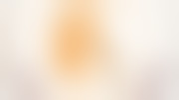 Post Pyeloplasty Stricture Lap Uretero Calycostomy