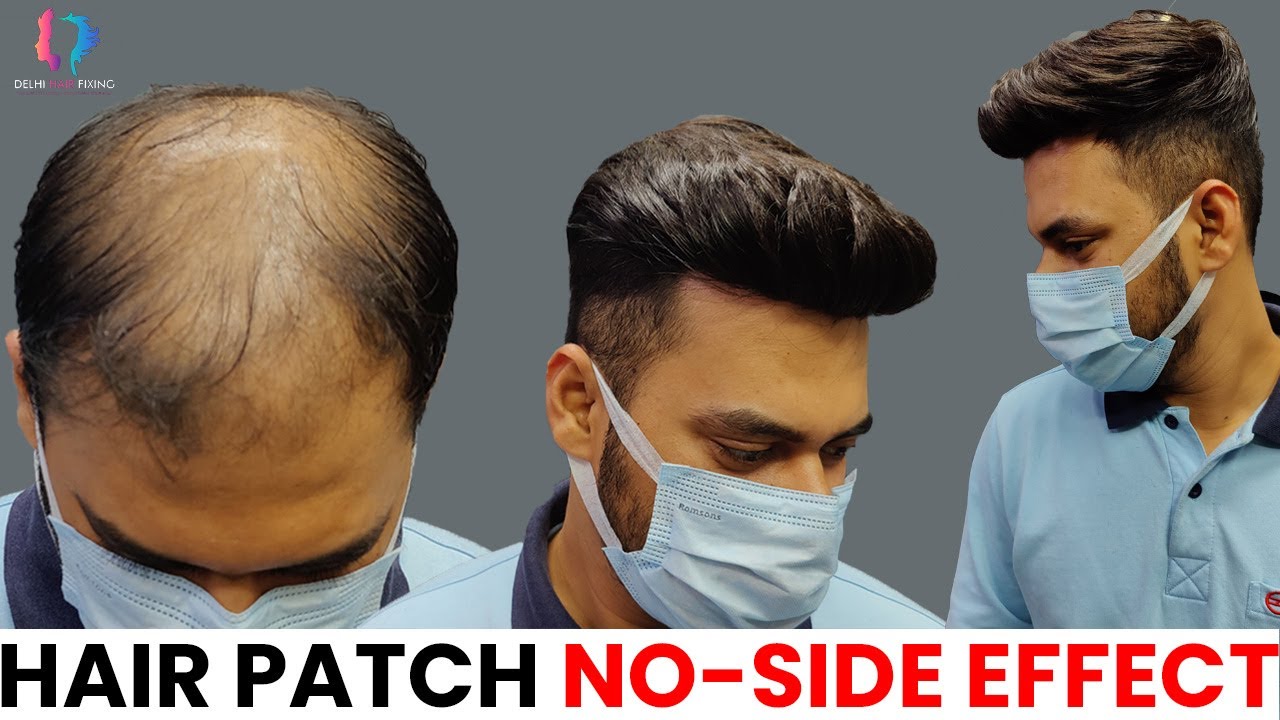 Men Hair Weaving Service In Delhi For Personal