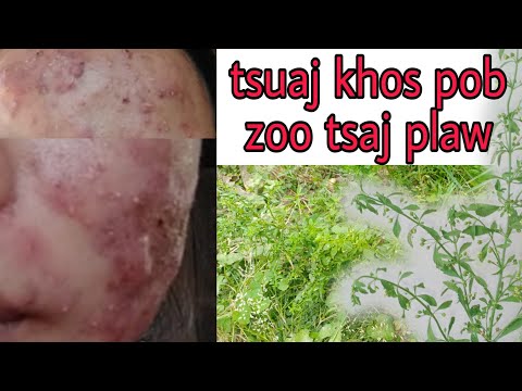 Video: Puas yog lub tshuab ua kom lub ntsej muag zoo?