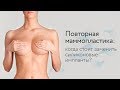 Повторная маммопластика: когда стоит заменить силиконовые импланты?