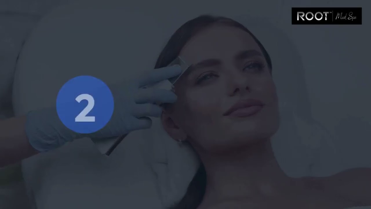 Botox Results You’ll Love in Flower Mound & Dallas, TX