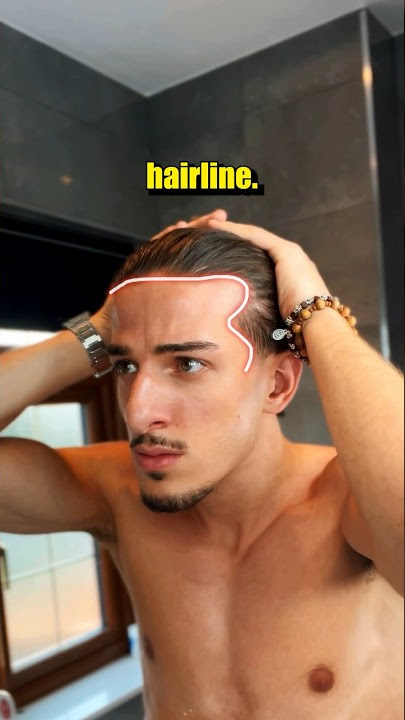 How To Know if You’re Going Bald! 😳 #hairloss #hair #shortsvideo
