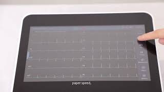 YSECG-E12 12-Channel ECG Machine | Smart Clinical ECG Solution
