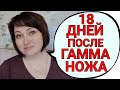 Какие осложнения после гамма-ножа? Облучённые метастазы в мозжечке меня &quot;укачивают&quot;.