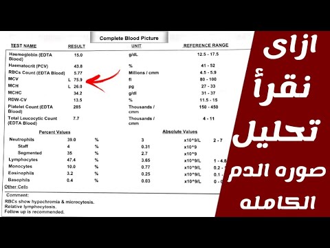 ازاى تقرأ تحليل صوره الدم الكامله تحليل 