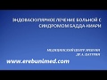 Впервые в Армении! В МЦ Эребуни проведено эндоваскулярное лечение больной с синдромом Бадда-Киари.