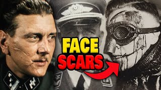 Why Did High-Ranking Nazis Have Face Scars?