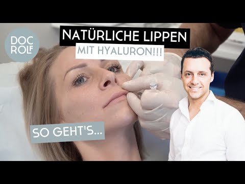 Video: Können Lippenfüller jemals natürlich aussehen?