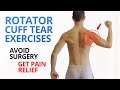 3 Keys to Rehab a Rotator Cuff Tear & AVOID Surgery [UNIQUE EXERCISES]