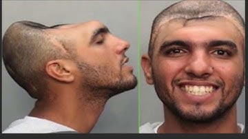 Warning: Disturbing Images of Deformities and Severe Medical Issues.  Viewer Discretion Advised.