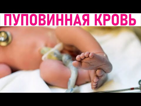 ЦЕННОСТЬ ПУПОВИННОЙ КРОВИ ДЛЯ РЕБЕНКА | Пуповинная кровь как страховка для здорового будущего