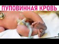 ЦЕННОСТЬ ПУПОВИННОЙ КРОВИ ДЛЯ РЕБЕНКА | Пуповинная кровь как страховка для здорового будущего