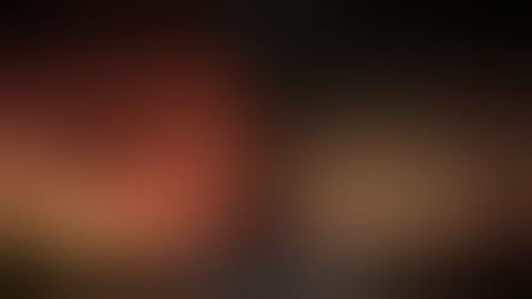 UNDERWATER POLYPECTOMY OF A FLAT ASCENDING COLON POLYP (LST-NG-F)