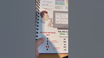 Spirometry is explained in 60s 🔃💨#medschool #medicalschool #usmle #usmlestep1 #usmlestep2