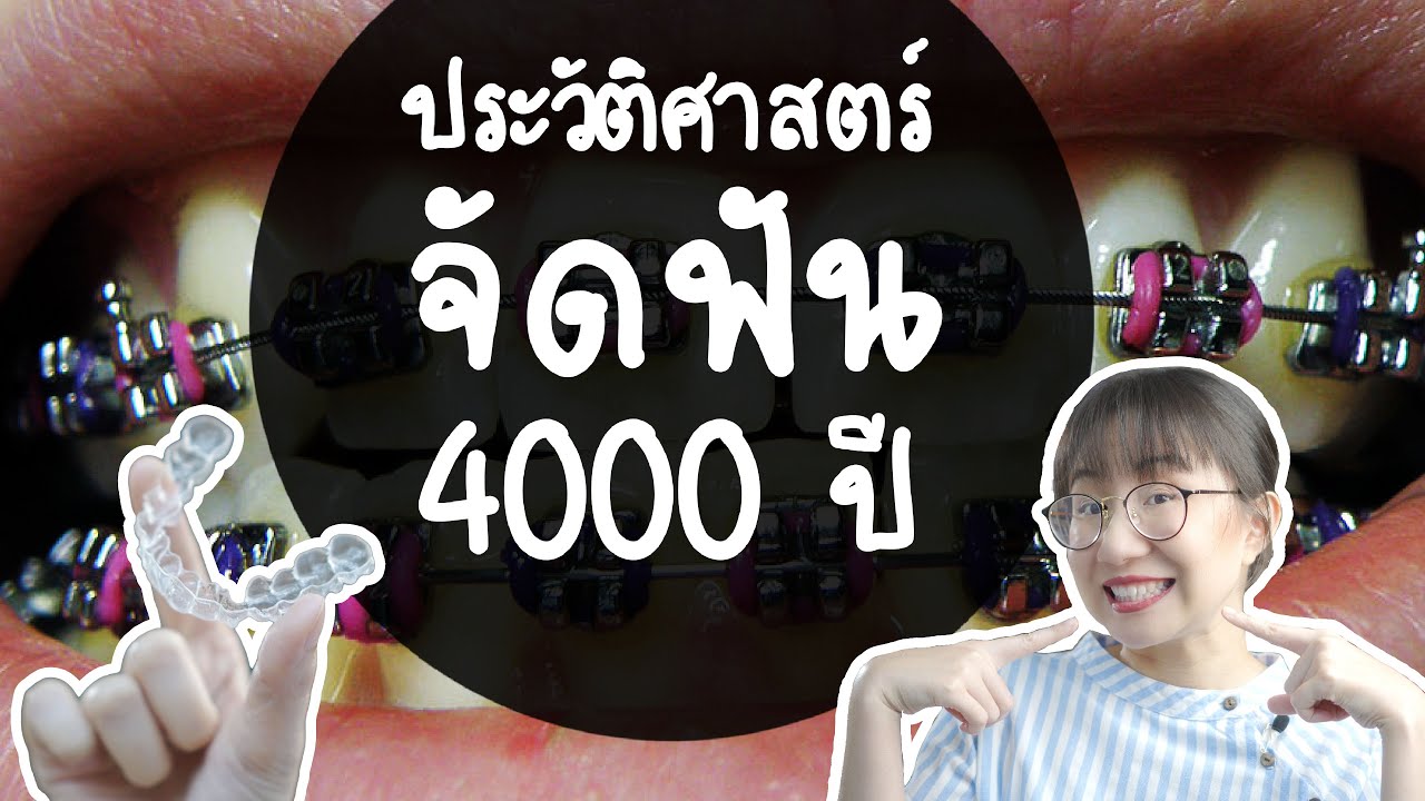 สี ดัด ฟัน  2022 Update  ประวัติศาสตร์การจัดฟัน 4000 ปี ! | Point of View x Invisalign
