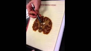 Neuroanatomy lab diencephalon and ventricles pt 2
