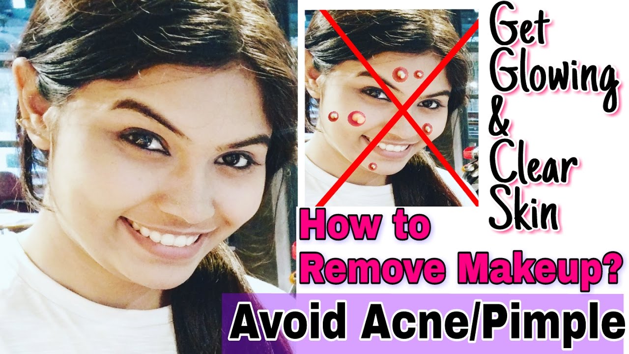 Image showcasing How to Remove Makeup to Avoid Acne & Pimples - YouTube