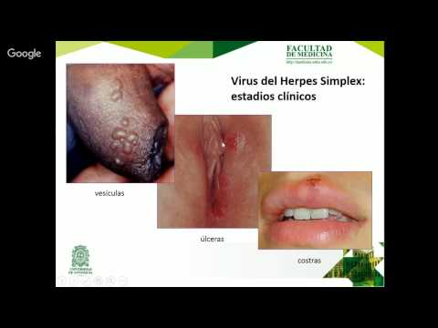 Vídeo: Diflucan - Instrucciones De Uso, Revisiones, Precio, Análogos, Cápsulas